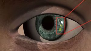 Smart Contact Lens Smart Contact Lens