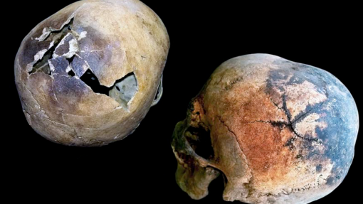 vesuvius skulls