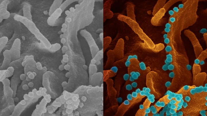 coronavirus virus killing a cell