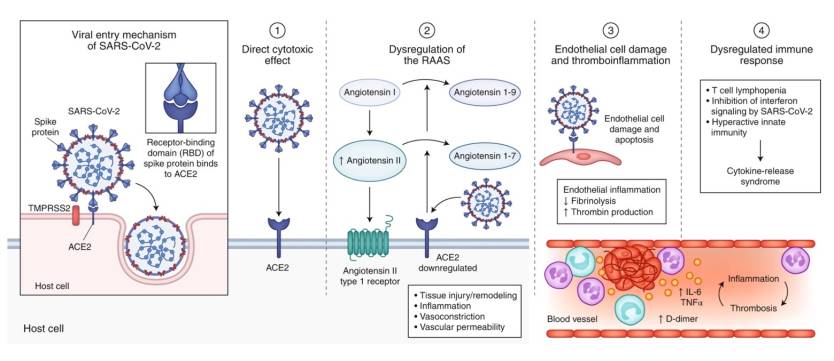 Coronavirus Extrapulmonary Manifestations