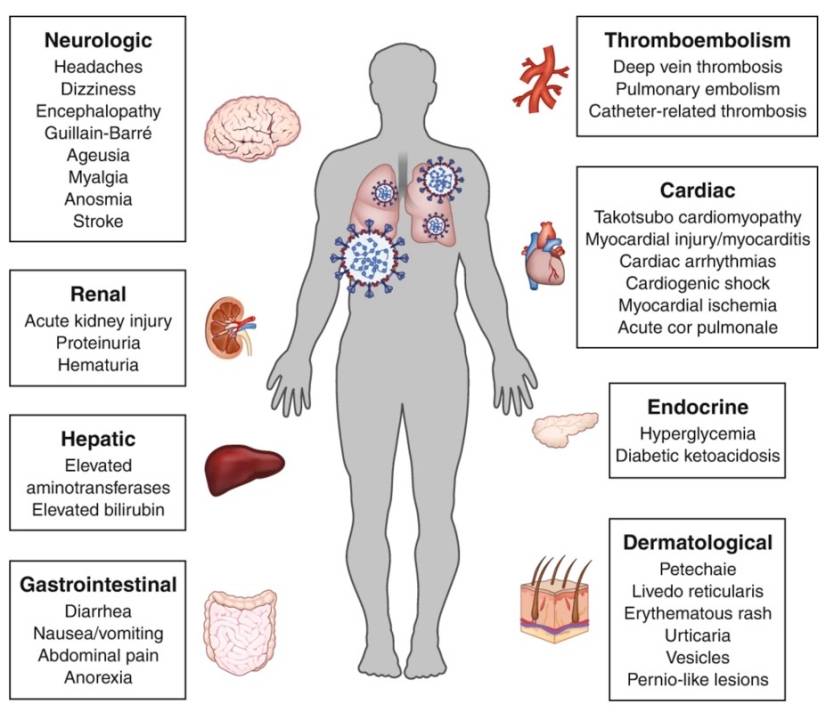 Coronavirus Extrapulmonary Manifestations