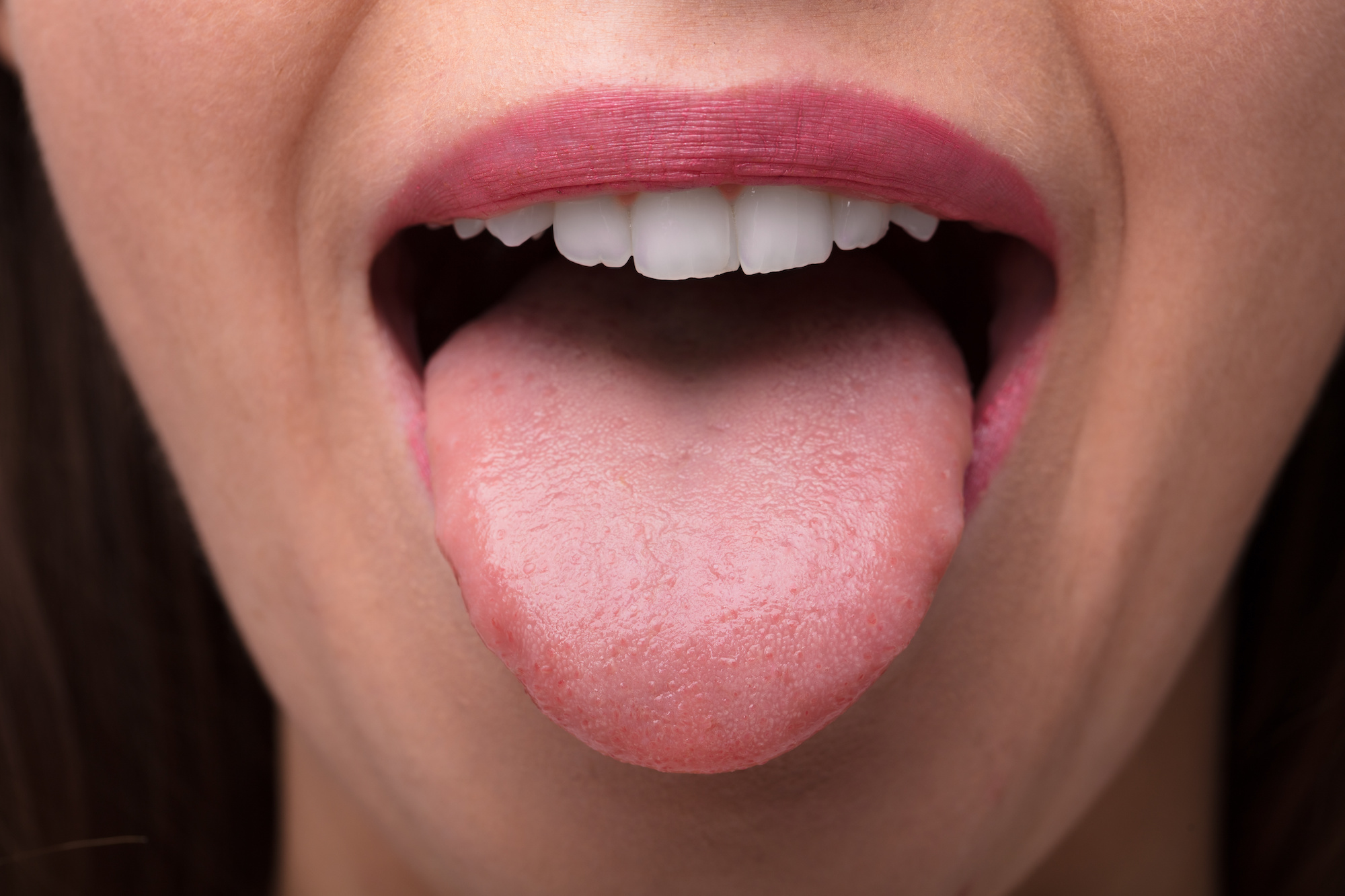 Crazy new AI can tell if you’re sick just by looking at your tongue