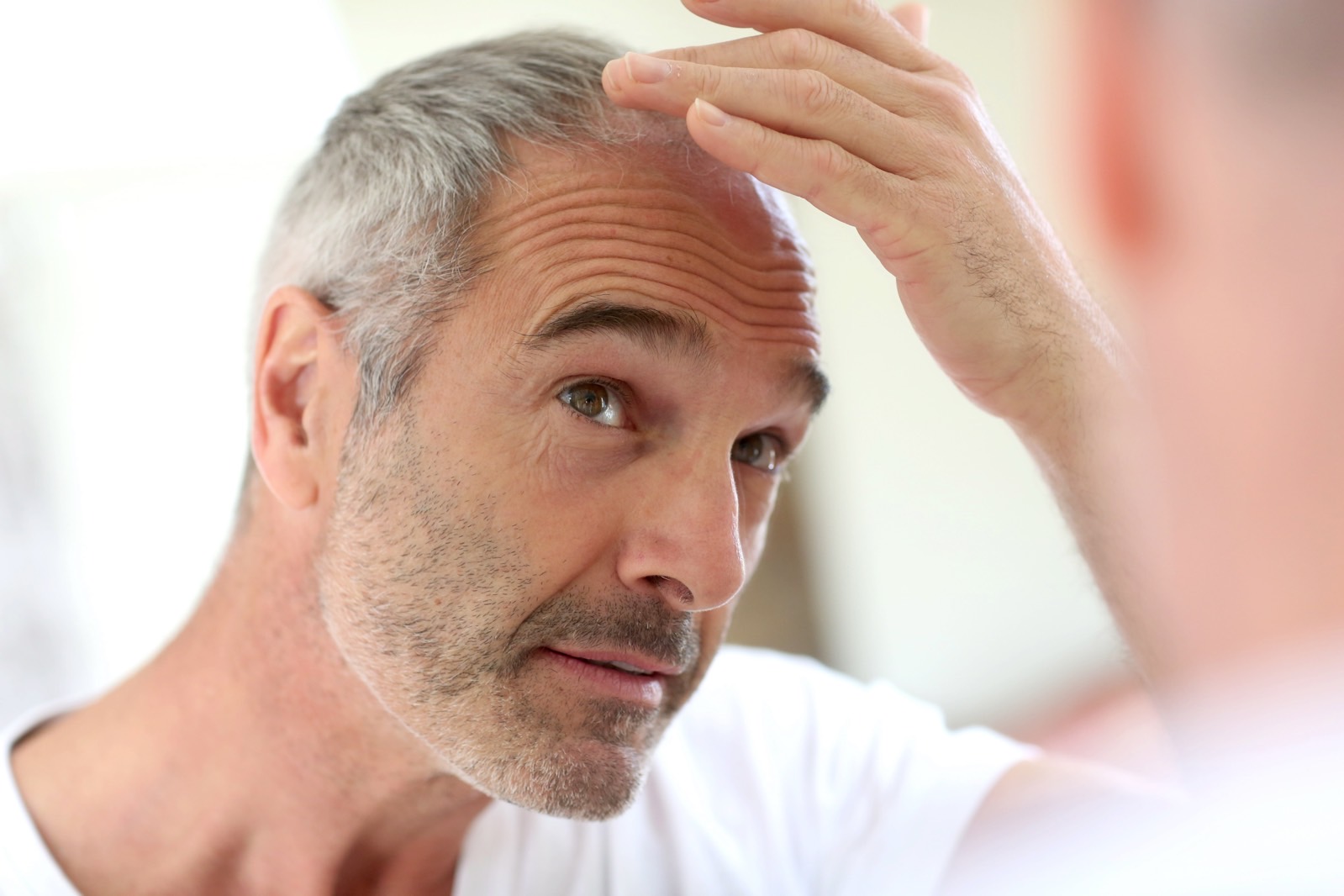 Researchers may have found a miracle cure for baldness – BGR