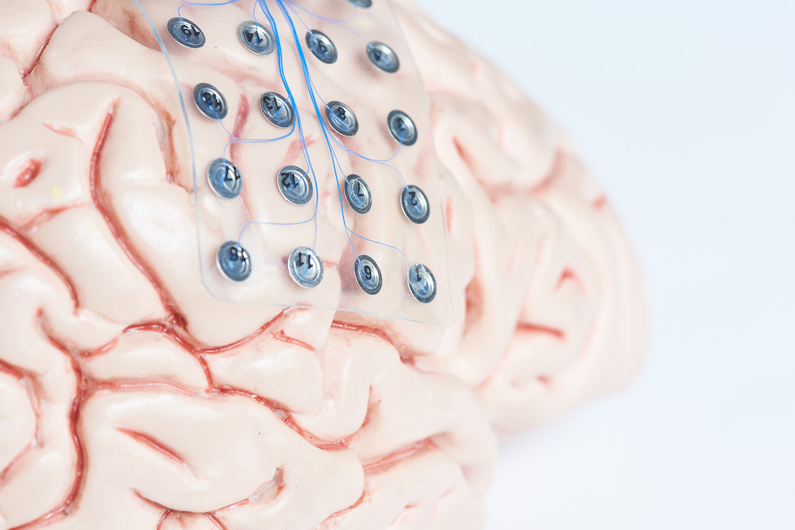 Cerebro humano con electrodos