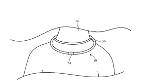 Patent illustration for Apple smart loop usages