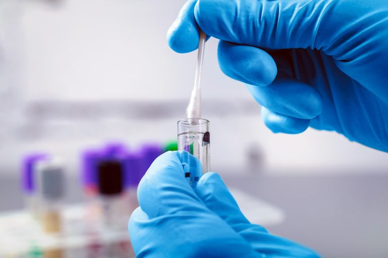 Scientist in a lab collects a DNA sample for a test