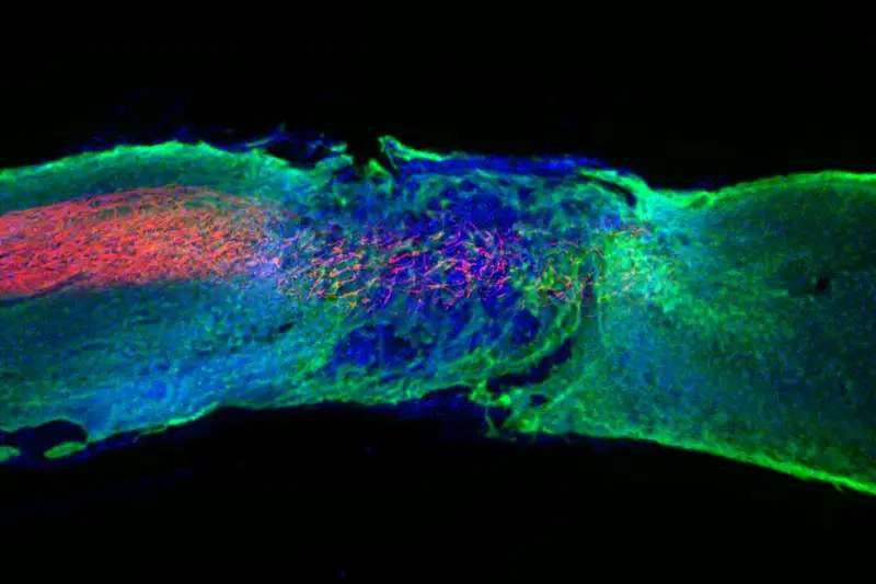 A section of the spinal cord in a mouse treated with the paralysis-healing gel