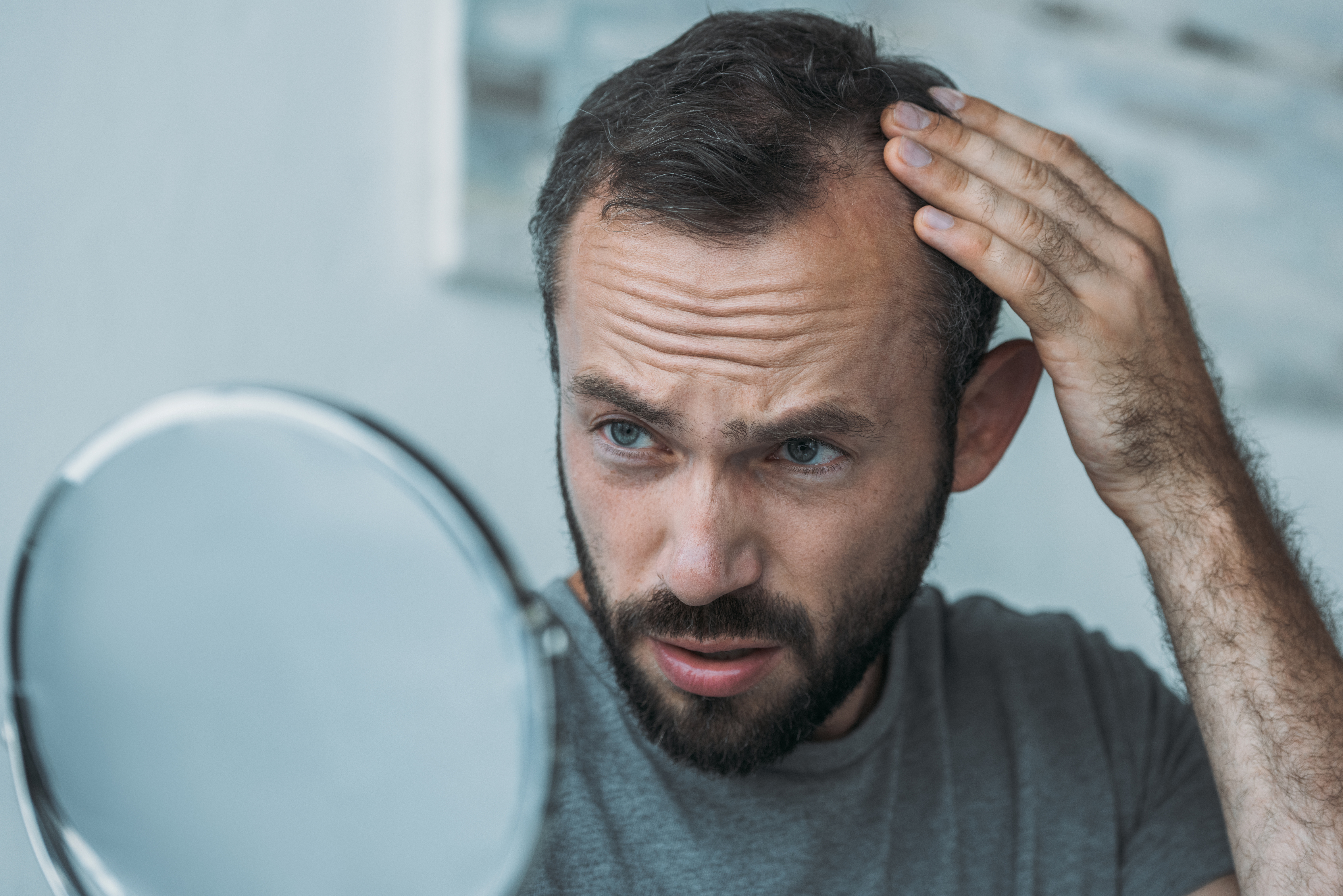 Middle-aged man upset looking at the mirror with alopecia, hair loss concept