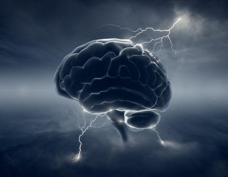 improve memory improve your memory, supercharged brain