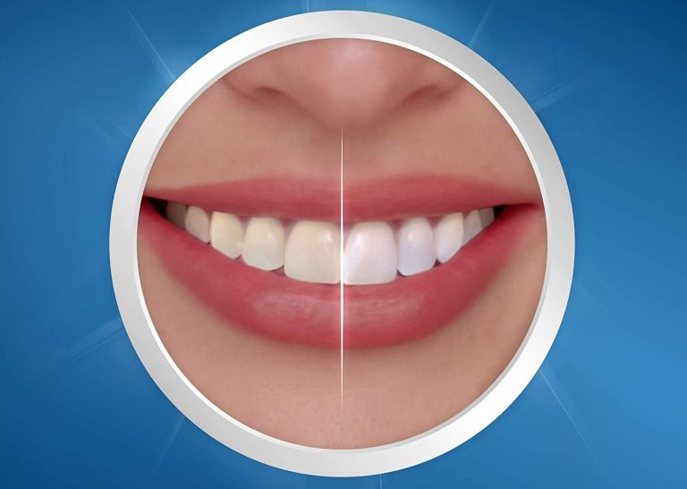 Prime Early Access Sale Deals On Crest 3D Whitestrips