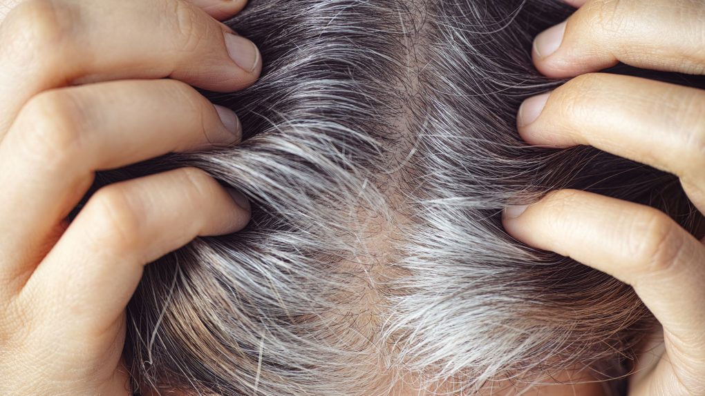 gray hair roots
