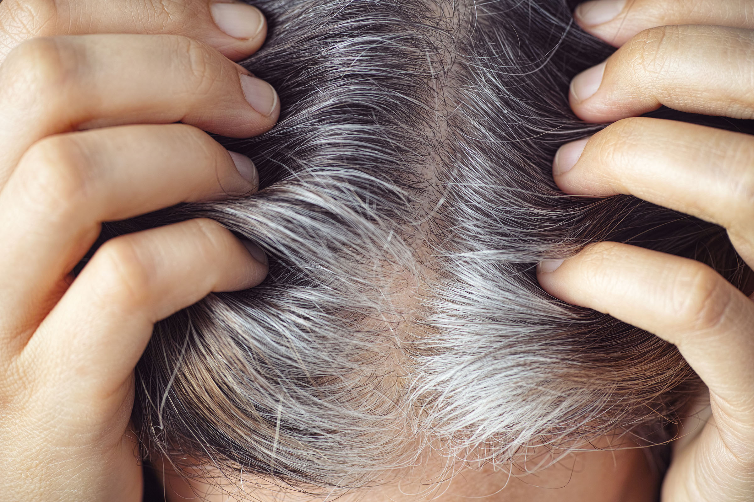 the-key-to-curing-gray-hair-may-have-just-been-discovered