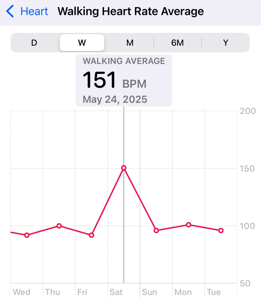 La Serie 10 Apple Watch pensó que estaba caminando.