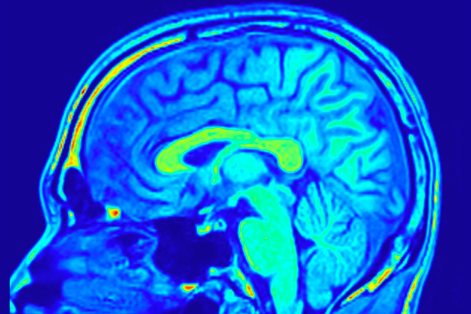 Our brains are glowing, and scientists want to figure out why