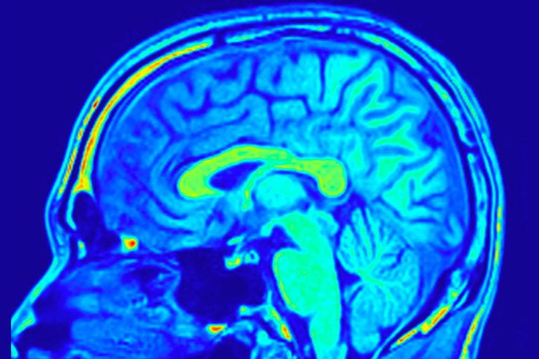 brain glowing under MRI