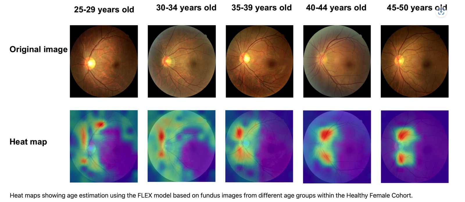 A figure from the study showing different heat maps for different age groups.